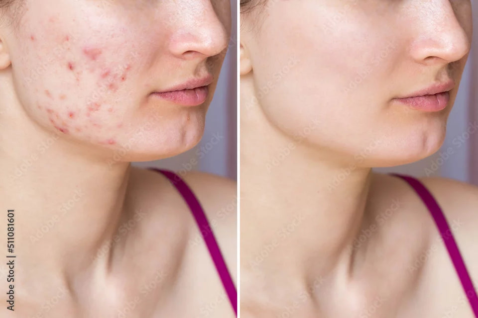 DARK SPOT CREAM